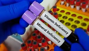 SHIVDYA HEALTH CARE Blog vitamin mineral